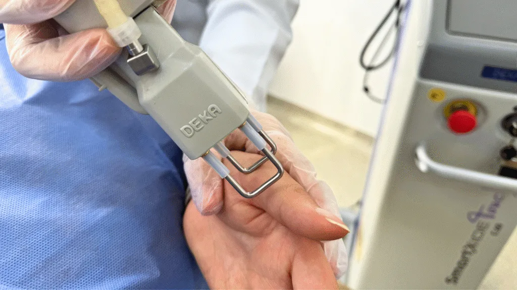 rejuvenecimiento de manos con laser co2
